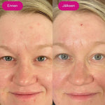Bio retinolivoide Flow Cosmetics Retin Lift 3-in-1 Cream ennen ja jälkeen asiakaskuva