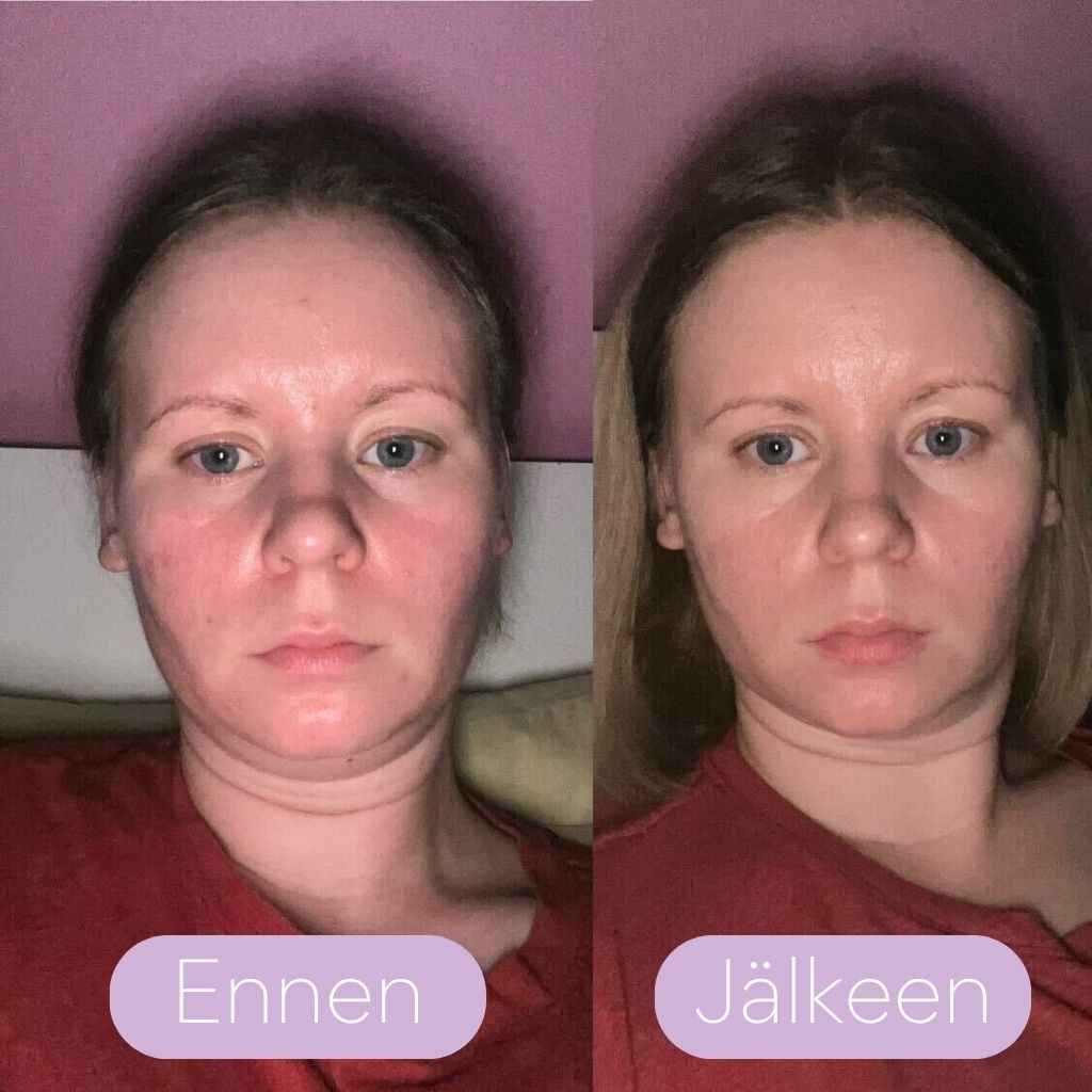 Esse Repair Oil ennen ja jälkeen käytön