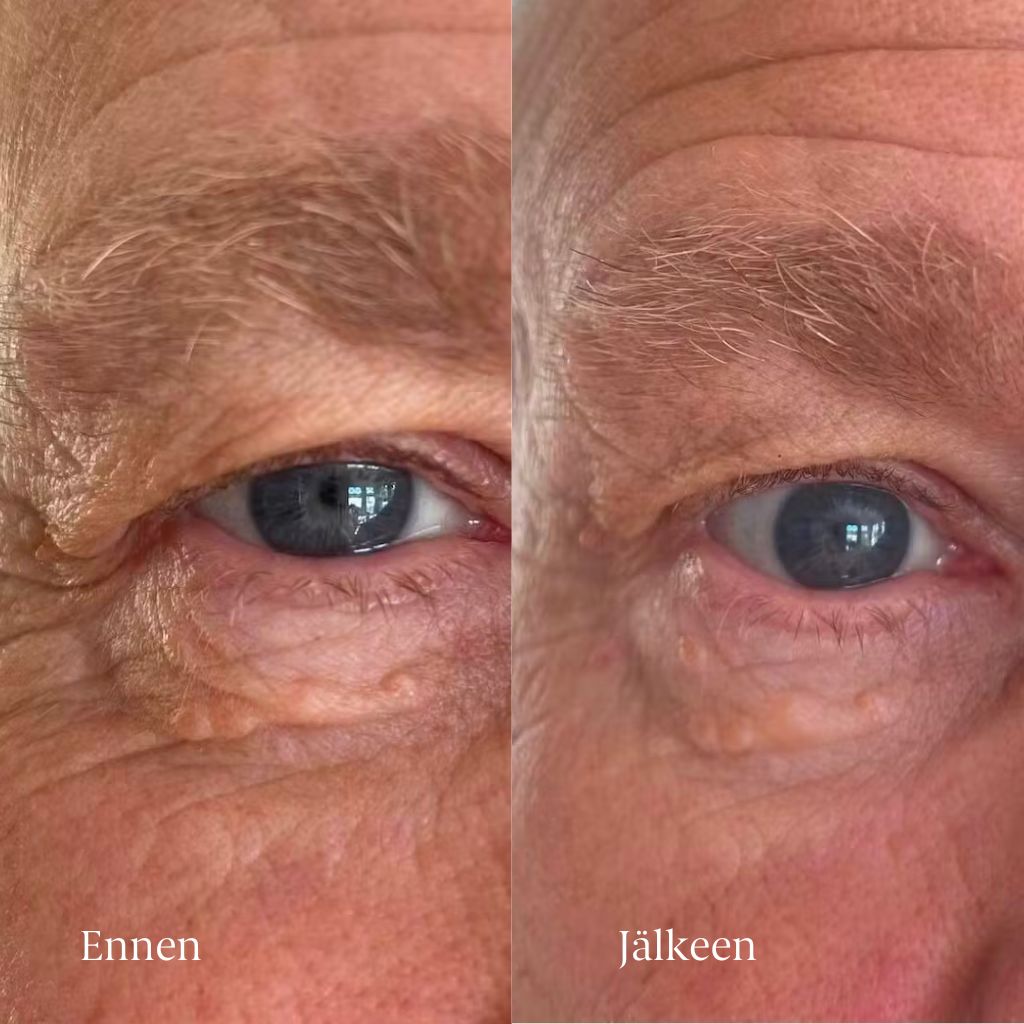 Flow Cosmetics Green Tea & Peptide Eye Cream silmänympärysvoide ennen ja jälkeen kuvat