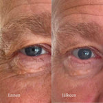 Flow Cosmetics Green Tea & Peptide Eye Cream silmänympärysvoide ennen ja jälkeen kuvat