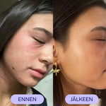Kosteusvoide Flow Cosmetics Propolis & Probiotics Rescue Cream asiakas kuva ennen ja jälkeen