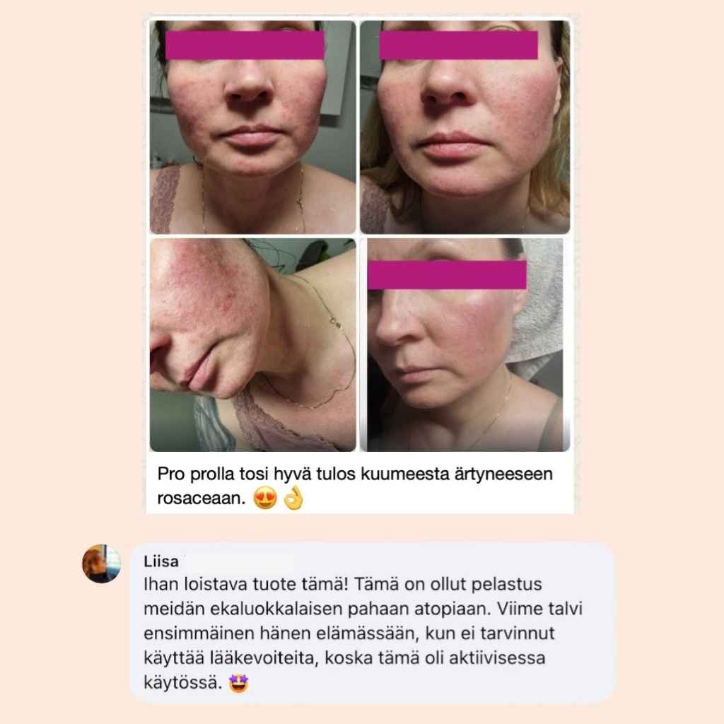 Flow Cosmetics Propolis & Probiotics Rescue Cream asiakasarvostelu