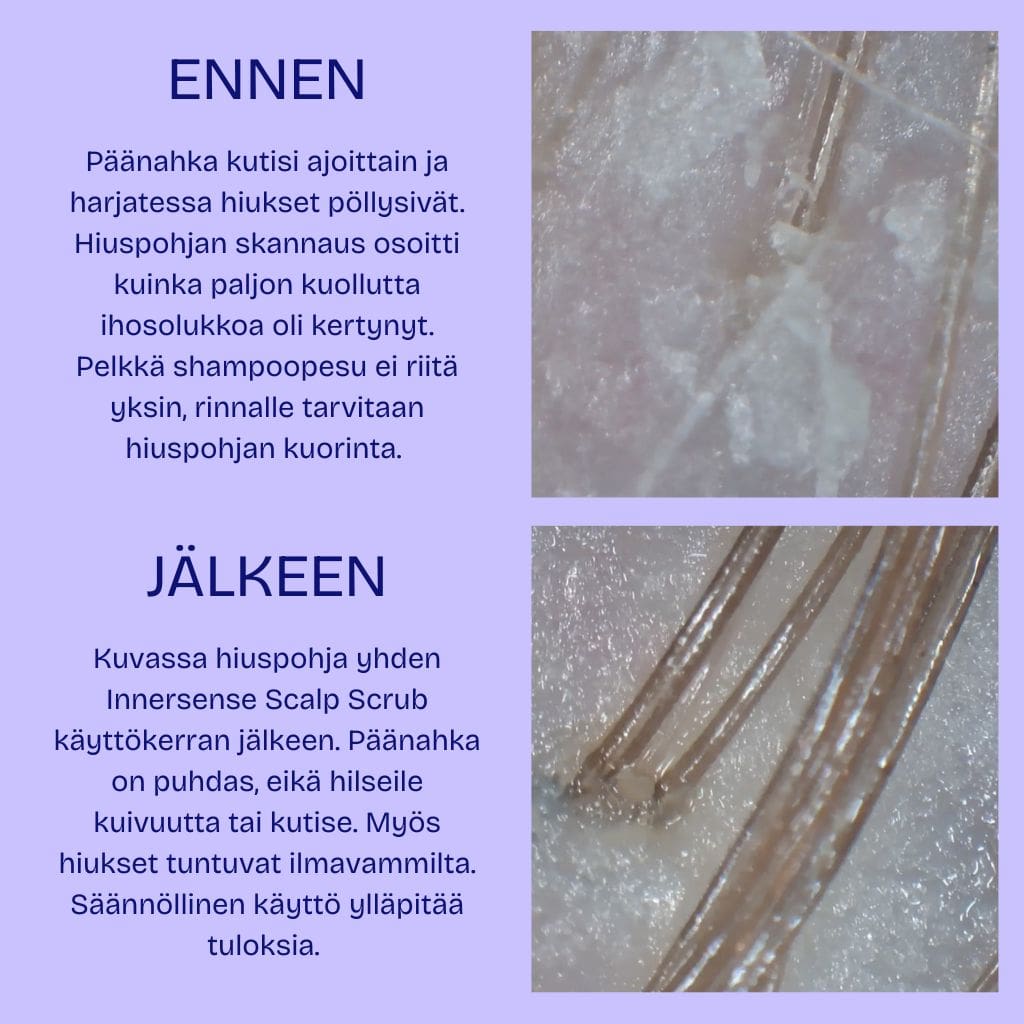 Hiuspohjan analyysi ja kuorinta ennen ja jälkeen