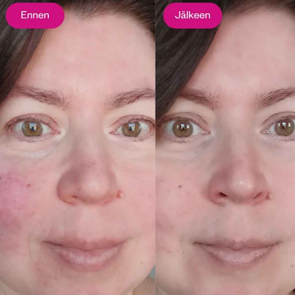 Kosteuttava kasvovoide Flow Cosmetics Arctic Beauty Cream ennen ja jälkeen käytön