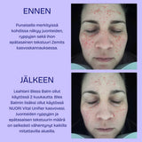 Leahlani Bless Balm ja NUORI VItal Unifier käyttö ennen ja jälkeen kuvat