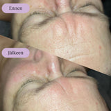 Yin Your Skin® Pro Gua Sha kasvohoito ennen ja jälkeen hoidon