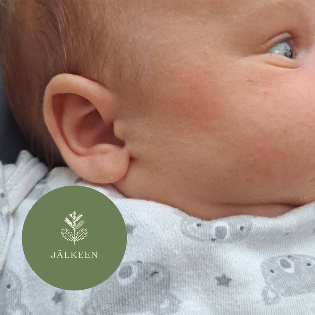 Moi Forest Nurturing Forest Dust Baby Cream käytön jälkeen